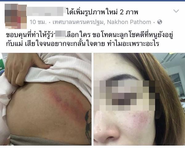 สาวท้องสุดระทม โดนเพื่อนสนิทแย่งสามี-ถีบท้องจนบาดเจ็บ ช้ำใจจนอยากตาย