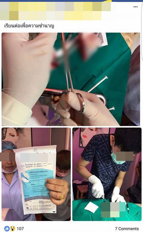 โซเชียลแฉ หมอเถื่อนโพสต์ชวนคนเป็น case study เสริมจมูกให้ฟรี !