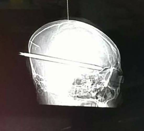 คดีฆ่าน้องปอนด์