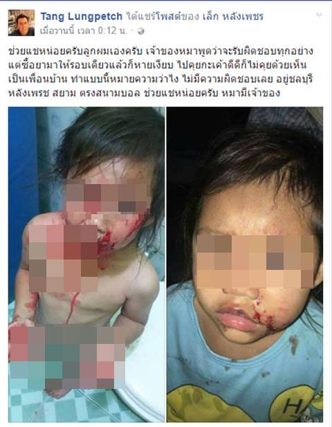 พ่อสุดช้ำ ลูกถูกหมาขย้ำหวิดเสียโฉม แต่เจ้าของตีมึน ซ้ำแจ้งความว่าเด็กกัดหมา