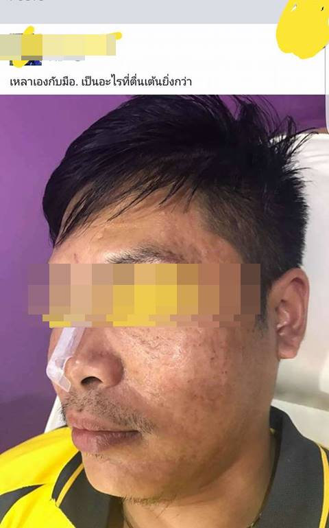 โซเชียลแฉ หมอเถื่อนโพสต์ชวนคนเป็น case study เสริมจมูกให้ฟรี !