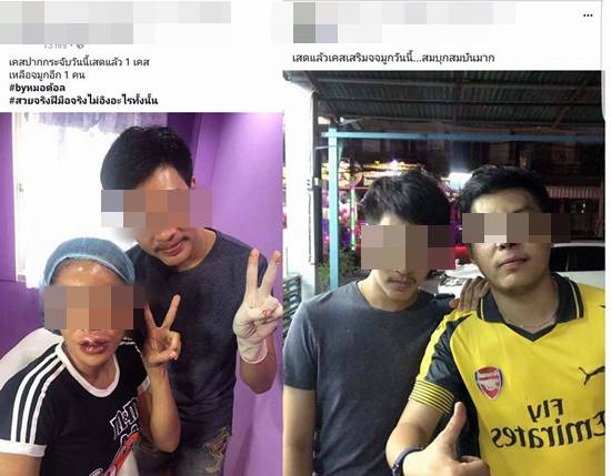 โซเชียลแฉ หมอเถื่อนโพสต์ชวนคนเป็น case study เสริมจมูกให้ฟรี !