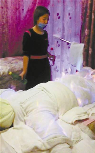 เสริมสวยจีนผุดวิธีสลายไขมันแบบพิสดาร ใช้ผ้าพันเป็นมัมมี่-จุดไฟเบิร์นกันไปเลย