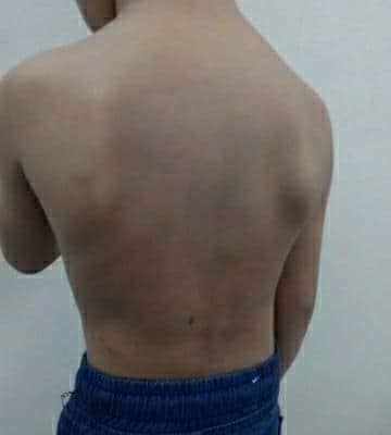 พ่อเลี้ยงทำร้ายลูกเลี้ยง