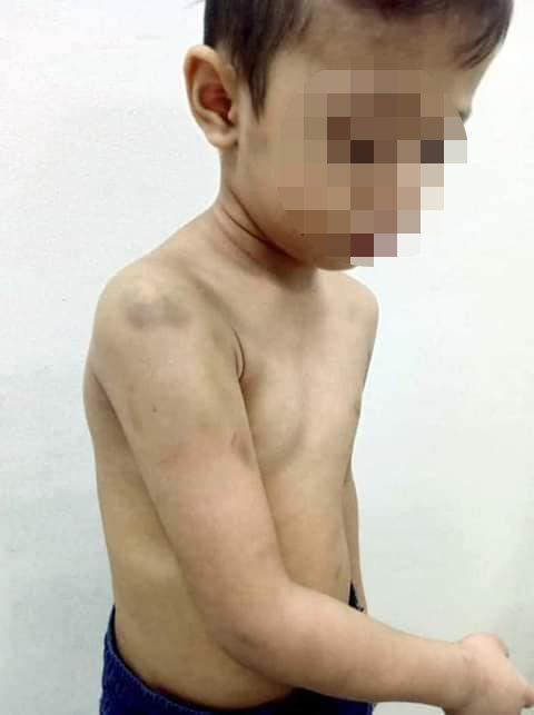 พ่อเลี้ยงทำร้ายลูกเลี้ยง