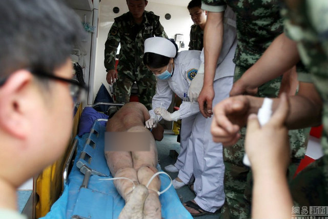 สงสัยจะร้อน หนุ่มเปลือยล่อนจ้อนปีนต้นไม้ห้อยหัวซะเลย