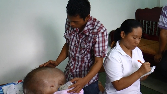 น้องภู เด็กหัวแตงโม