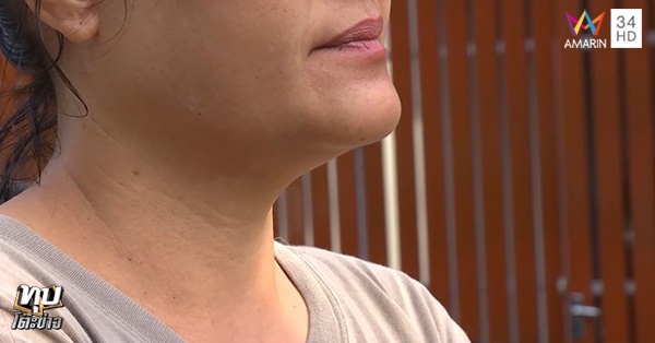 คดีหวย 30 ล้าน