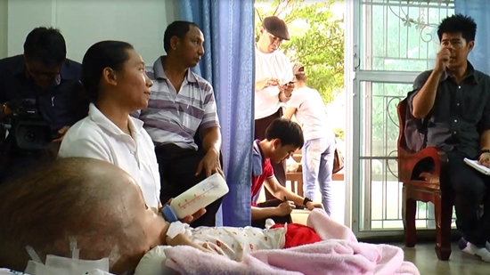 น้องภู เด็กหัวแตงโม