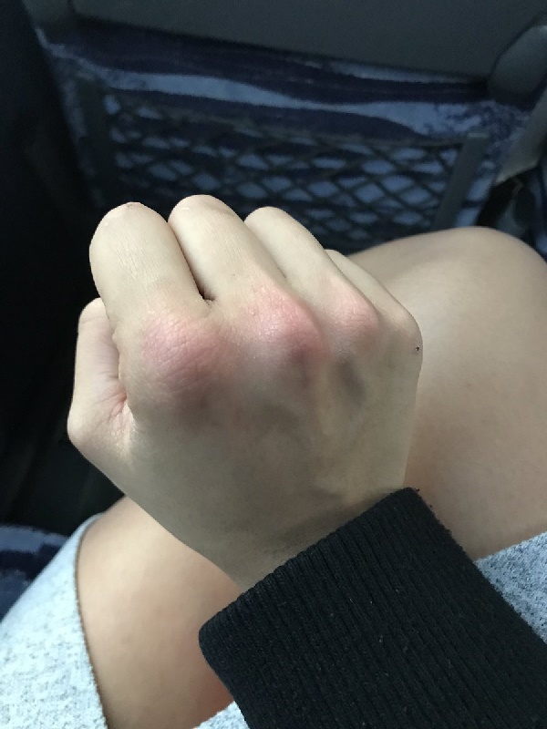 สาวสวยถูกคนลวนลาม