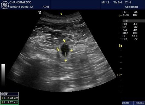 แพนด้าหลินฮุ่ย