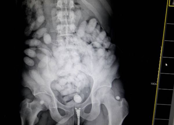 ตำรวจจับยาบ้า