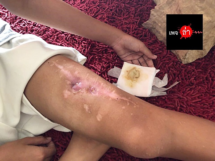  แม่เล่นยา 