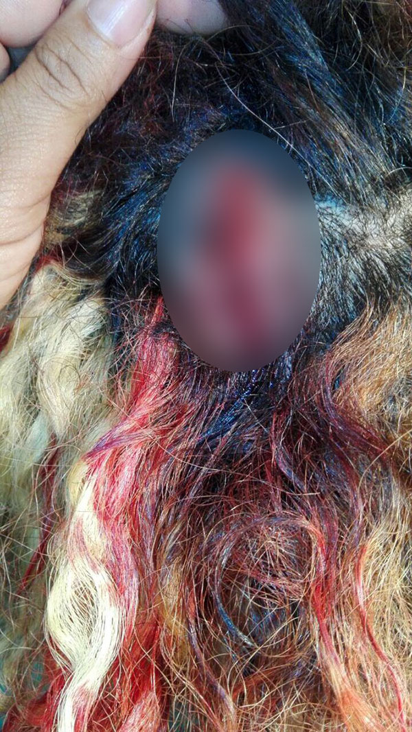 ภริยาผู้นำซิมบับเวทำร้ายร่างกายนางแบบ