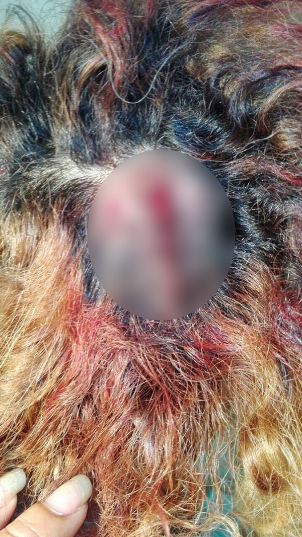 ภริยาผู้นำซิมบับเวทำร้ายร่างกายนางแบบ