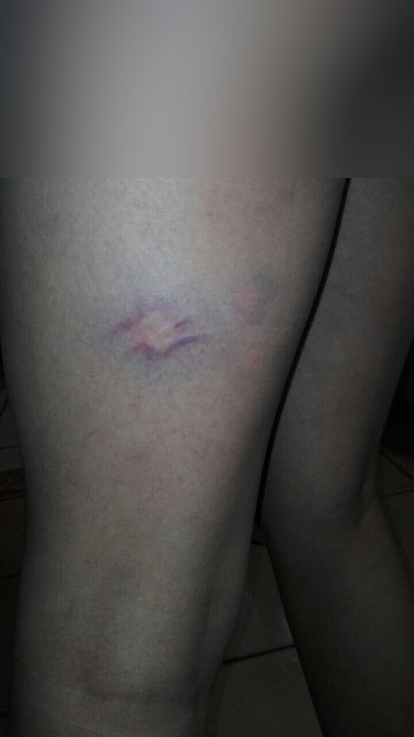 ภริยาผู้นำซิมบับเวทำร้ายร่างกายนางแบบ