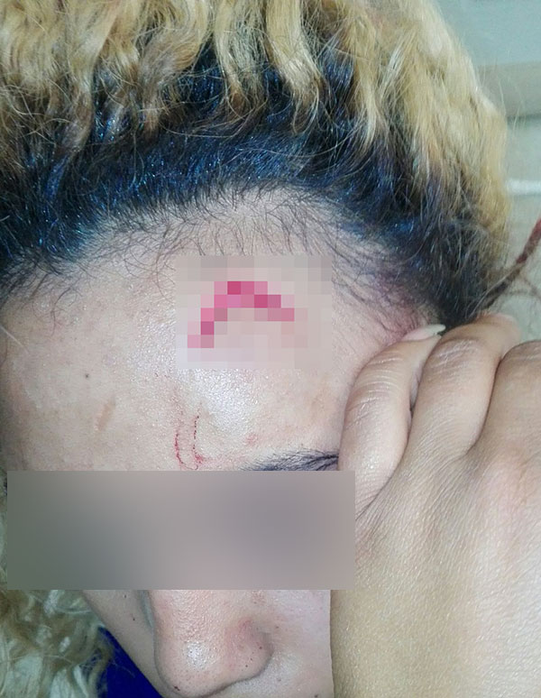 ภริยาผู้นำซิมบับเวทำร้ายนางแบบ