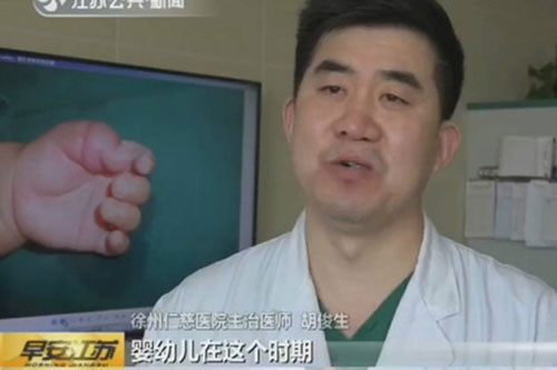 หนูน้อยวัย 2 เดือน หวิดเสียนิ้วโป้ง หลังเส้นผมแม่รัดแน่นจนฝังติดเนื้อ !