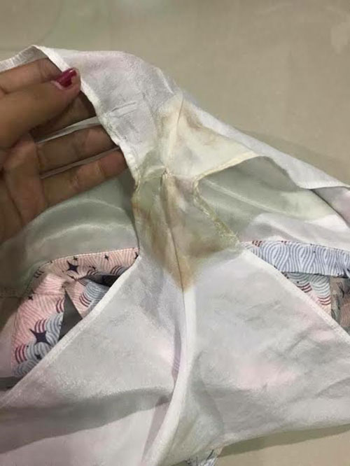 สาวช็อกซื้อชุดผ่านเฟซบุ๊ก คนขายยันไม่มีตำหนิ แต่พอได้ของไหงเป็นงี้