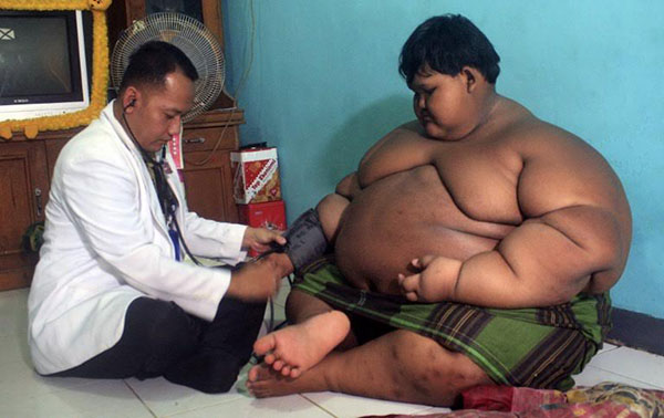 เด็กอินโดฯ น้ำหนักพุ่ง 190 กิโลกรัม