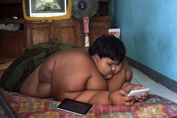 เด็กอินโดฯ น้ำหนักพุ่ง 190 กิโลกรัม