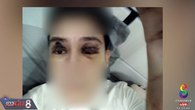 ศัลยกรรมทำพิษ