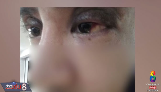 ศัลยกรรมทำพิษ