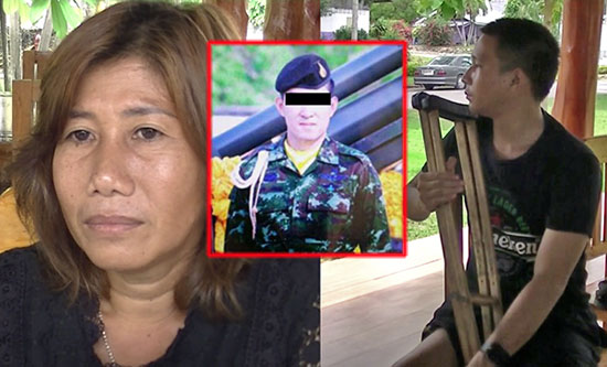 อดีตพลทหารถูกลงโทษขาหัก