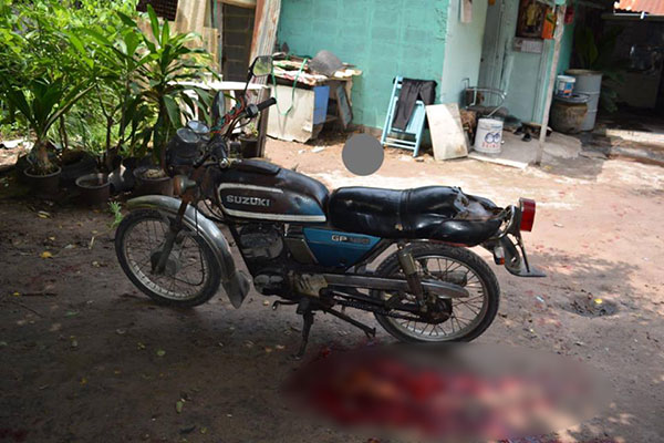 คุณตาถูกทีวีระเบิดใส่ขา