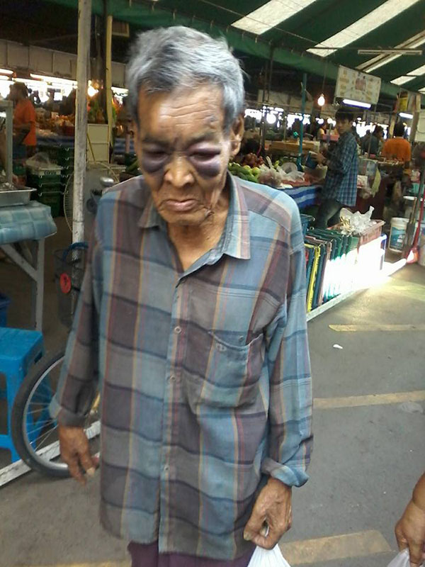 คุณตาเดินตลาดทั้งที่ตาบวมช้ำ คาดฝีมือคนในครอบครัว 