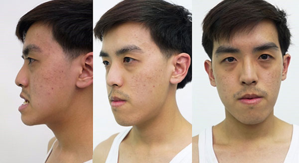 บอล Let Me In 3