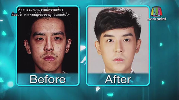 บอล Let Me In 3