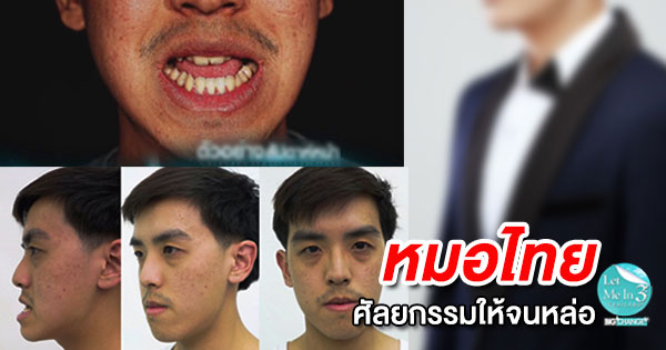 บอล Let Me In 3