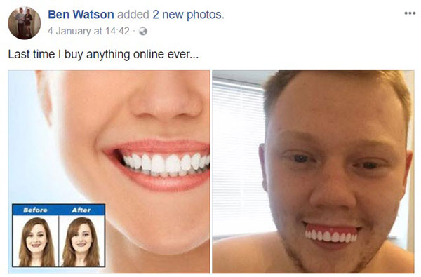 หนุ่มซื้อฟันปลอมทางเน็ต กะว่าใส่แล้วเท่ แต่เงิบหนัก