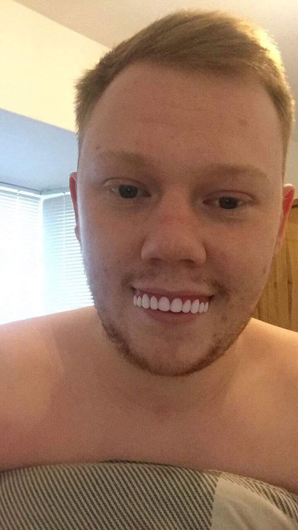 หนุ่มซื้อฟันปลอมทางเน็ต กะว่าใส่แล้วเท่ แต่เงิบหนัก