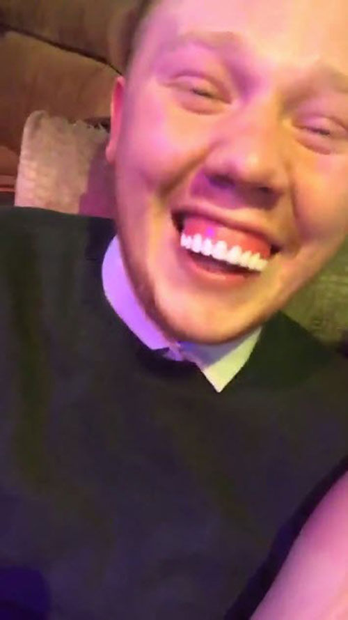 หนุ่มซื้อฟันปลอมทางเน็ต กะว่าใส่แล้วเท่ แต่เงิบหนัก