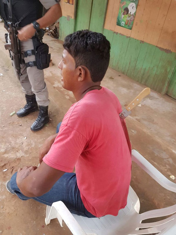 หนุ่มโดนมีดปักกลางหลัง แต่ยังยืนคุยได้อย่างชิล บอกงงไม่รู้มีดมาจากไหน