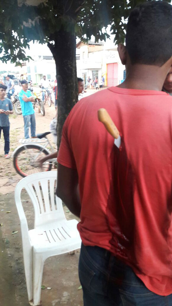 หนุ่มโดนมีดปักกลางหลัง แต่ยังยืนคุยได้อย่างชิล บอกงงไม่รู้มีดมาจากไหน