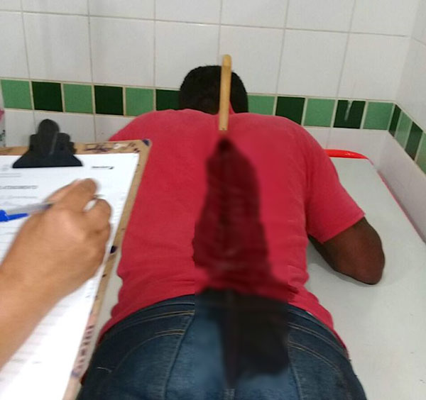 หนุ่มโดนมีดปักกลางหลัง แต่ยังยืนคุยได้อย่างชิล บอกงงไม่รู้มีดมาจากไหน