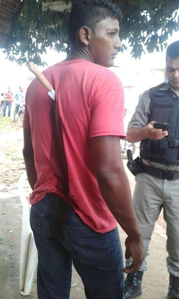 หนุ่มโดนมีดปักกลางหลัง แต่ยังยืนคุยได้อย่างชิล บอกงงไม่รู้มีดมาจากไหน