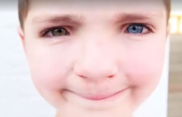 เด็กตา 2 สี ถูกล้อมาทั้งชีวิต ได้แมวตา 2 สี คู่ซี๊เหมือนเป๊ะ หายเศร้าเลย