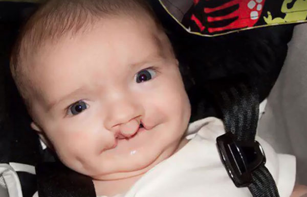 เด็กตา 2 สี ถูกล้อมาทั้งชีวิต ได้แมวตา 2 สี คู่ซี๊เหมือนเป๊ะ หายเศร้าเลย