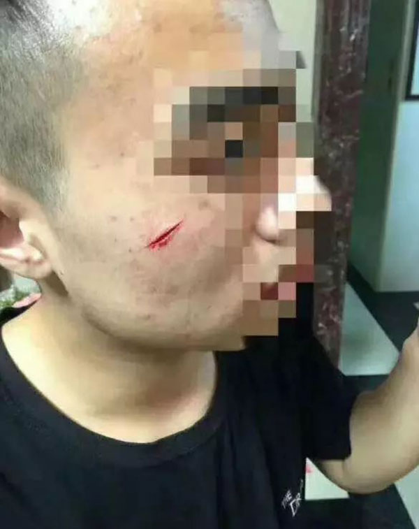 เล่นแรงไปไหม แก๊งเพื่อนคว้าค้อนทุบประตู-บุกบ้านเจ้าสาว ดุเดือดถึงขั้นได้เลือด 