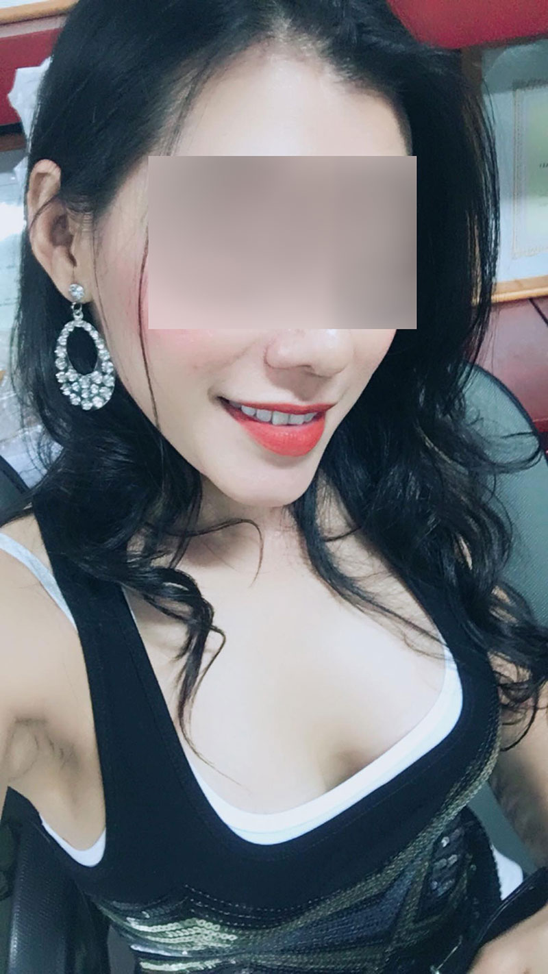 นักร้องสาวช้ำ หน้าอกระเบิดกลางเครื่องบิน เหตุซิลิโคนห่วย-หมอไม่รับผิดชอบ 