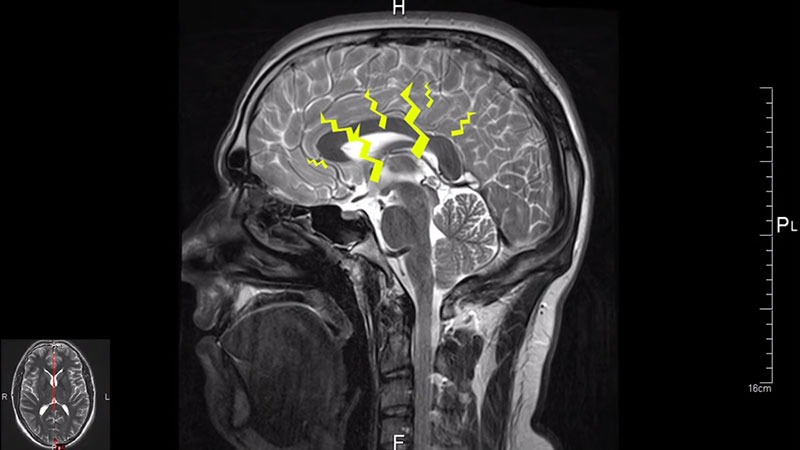 ไขความลับ.. ความฝัน เกิดจากอะไร ทำไมคนเราถึงฝัน !?