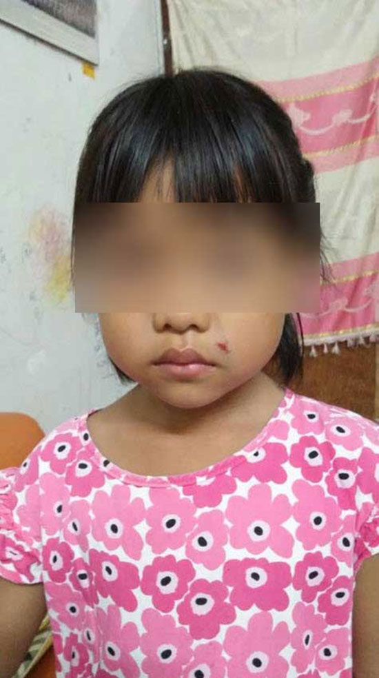 พ่อช้ำคูณ 2 ลูกถูกรุ่นพี่เขวี้ยงไม้กวาดใส่หน้า ครูบอกวิธีแก้คือ อยู่บ้าน ไม่ต้องมาเรียน !