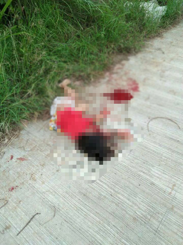 หมากัดเด็ก