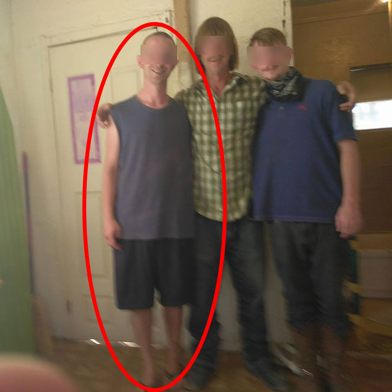 น้องชายจิตป่วย เสียบดาบทะลุกะโหลกพี่ชาย เพราะคิดว่าเป็นมนุษย์กิ้งก่า  