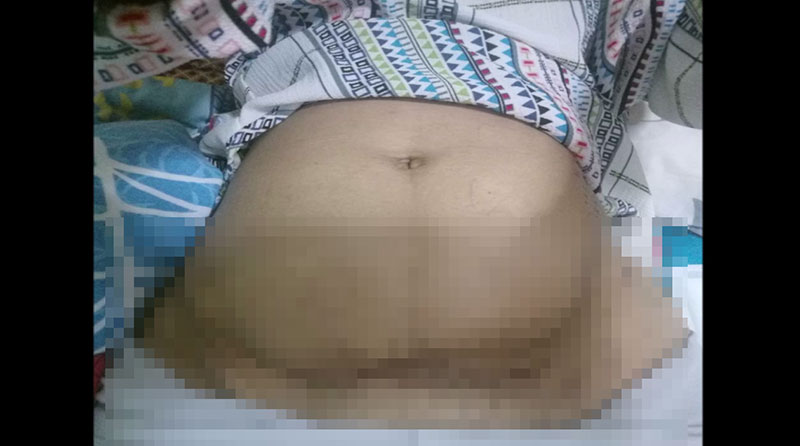 ผ่าตัดพลาด