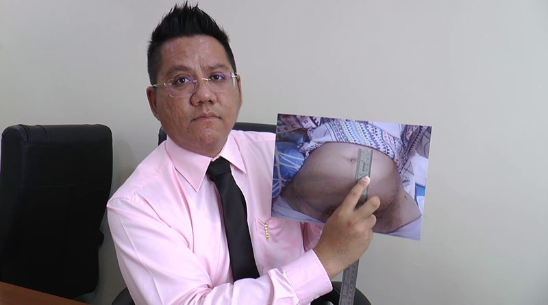 ผ่าตัดพลาด